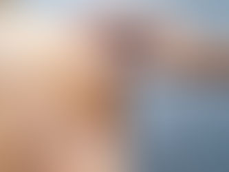 How Do Dermatologists Remove Stubborn Moles?