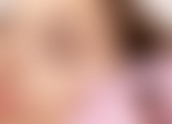 How Does Mesotherapy Treatment Help With Skin Rejuvenation?