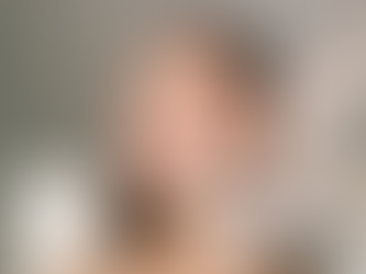 Skin Booster Injection Dubai