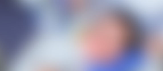 Pico Laser Treatment in Dubai