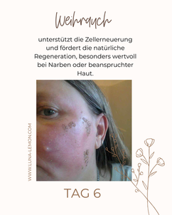 Wundheilung mit ätherischen Ölen Tag 10