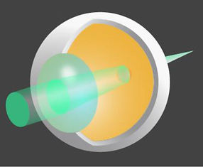 遠視・老眼(Presbyopia・Hyperopia)