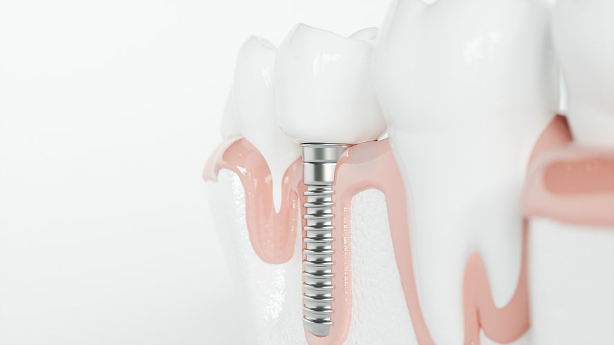 AdobeStock_286159780.jpeg