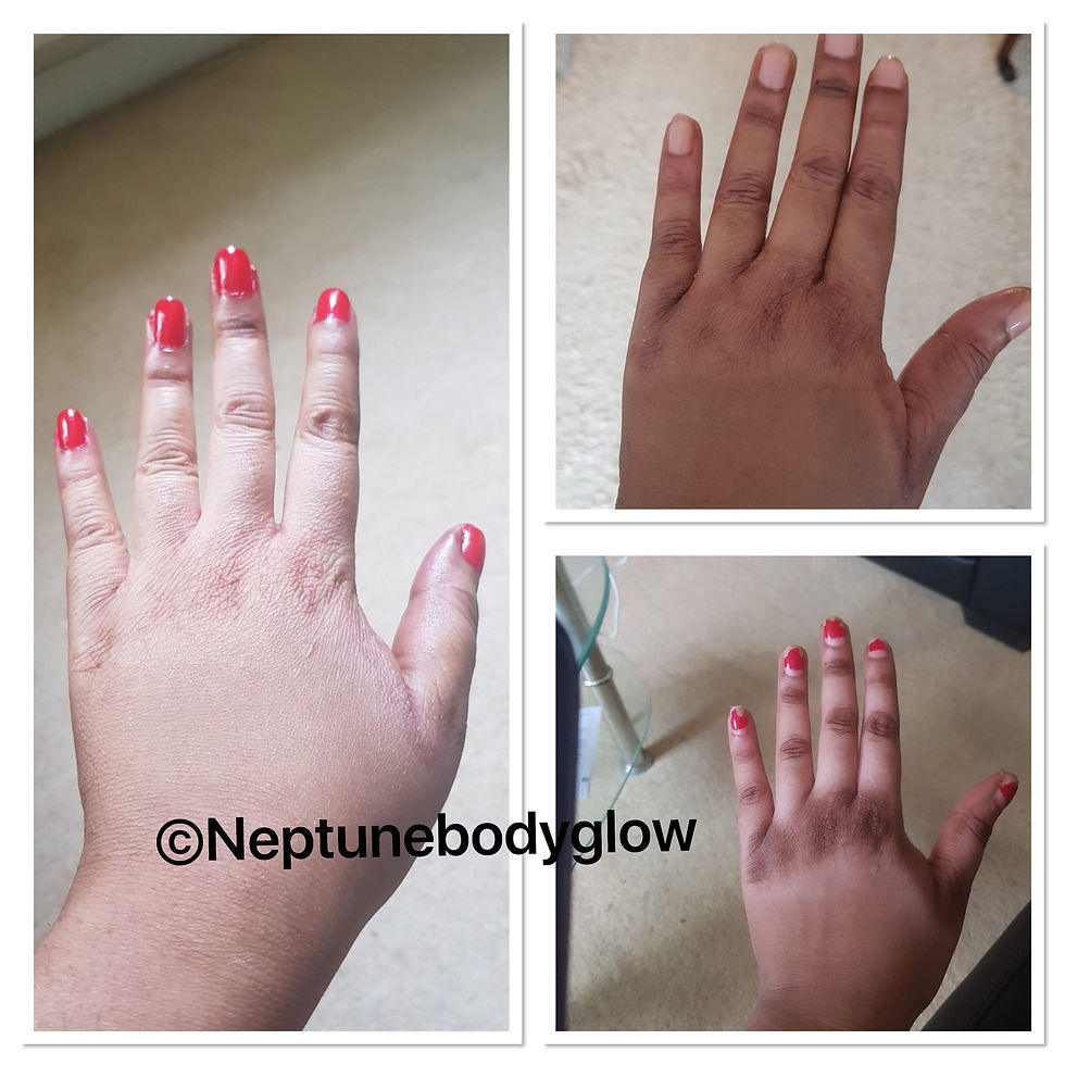 Thumbnail: Dark Knuckle Set