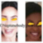 Woman with lightened skin