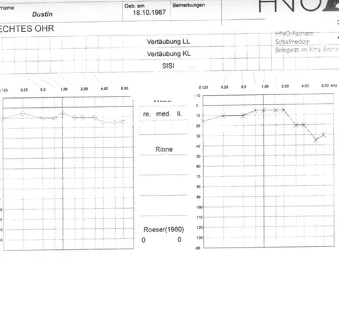 Audiometrie 2 - Kontrollmessung bei HNO-Facharzt und Schlafmedizin