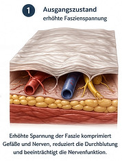 Fasziensystem als funktionelle Schnittstelle für Nervensystem, Spannung und Durchblutung