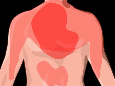 El infarto de miocardio, también conocido como ataque al corazón, es una de las principales causas de muerte a nivel mundial. Reconocer sus síntomas a tiempo, entender sus causas y adoptar medidas de prevención son claves para reducir su riesgo. Este artículo explica de manera clara cómo identificar un infarto, qué factores lo desencadenan y qué hacer en caso de emergencia. Además, ofrece consejos prácticos sobre cómo mantener un corazón saludable mediante una dieta balanceada, ejercicio regular y control de condiciones como hipertensión, colesterol y diabetes.