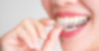 Are-Clear-Aligners-As-Effective-As-Traditional-Braces.jpg