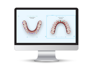 Effective Clear Aligner Therapy Strategies for Orthodontists
