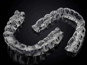 Streamlining Orthodontic Clear Aligner Treatment Planning