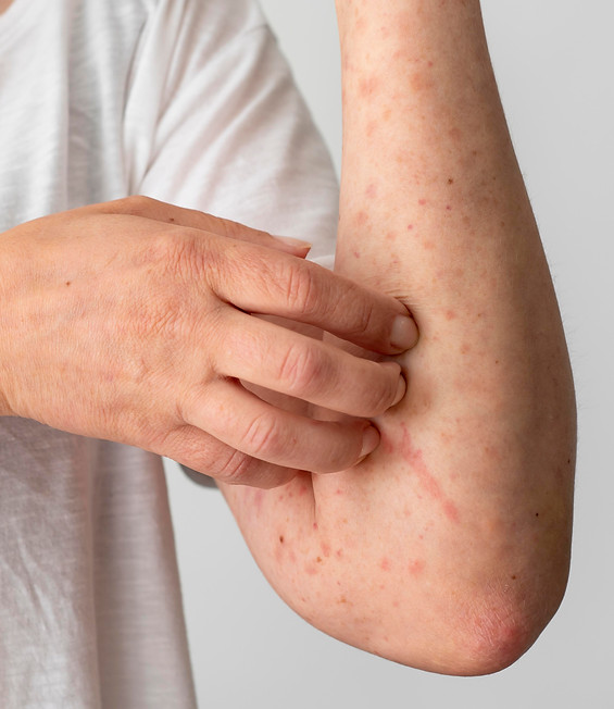 skin-allergy-reaction-person-s-arm.jpg