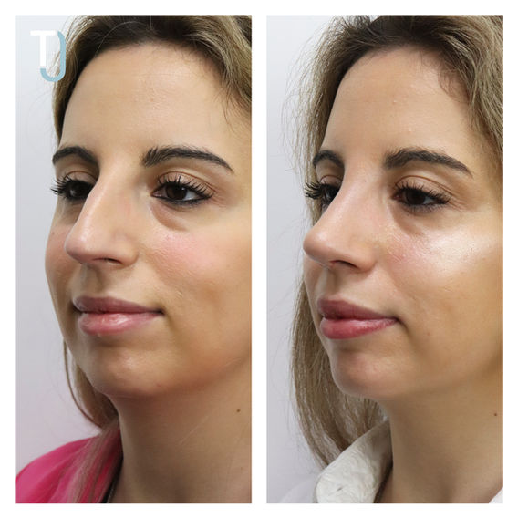 Joana Ferreira 4.jpg