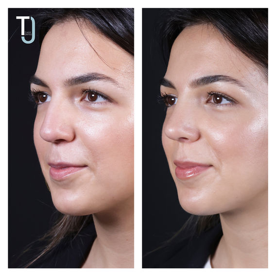 Ine╠és Miranda 5.jpg