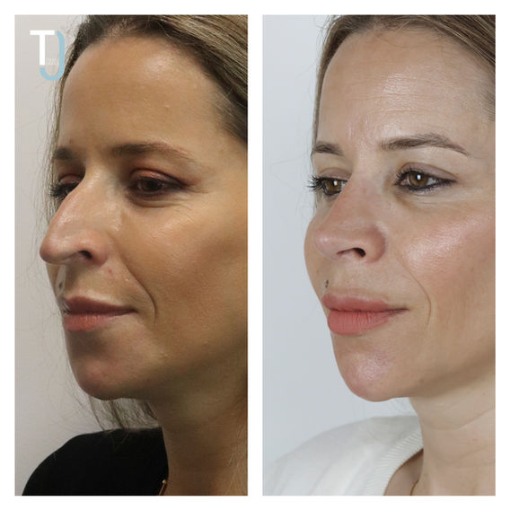 Ta╠énia Lage 4.jpg