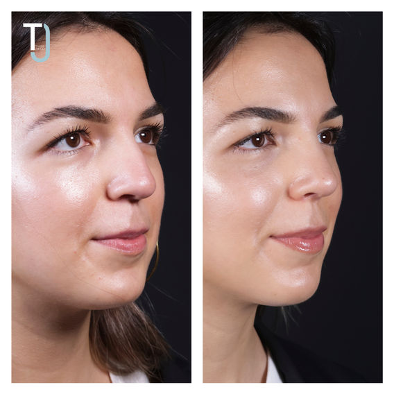 Ine╠és Miranda 3.jpg