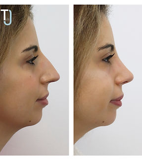 Joana Ferreira 1.jpg