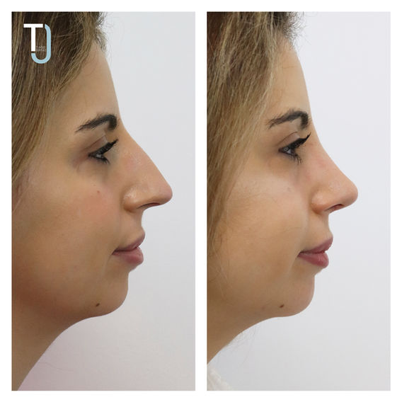 Joana Ferreira 1.jpg