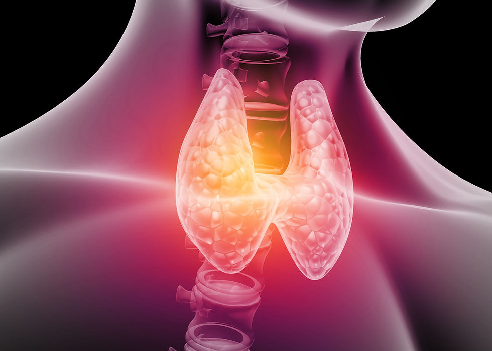 Medical illustration of the thyroid gland in the neck showing inflammation — relevant to thyroid surgery and thyroidectomy performed by Dr Vyas Prasad at Absolute ENT, Singapore