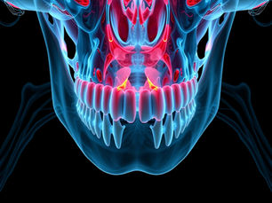 Maxillary Sinusitis: Why Cheekbone Pain and Blocked Nose May Be Coming from Your Sinuses