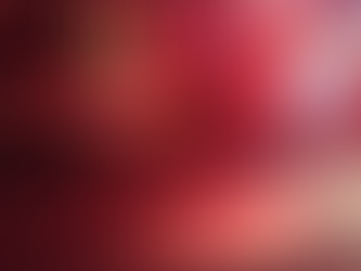 Atropelamento na SC-157 deixa mulher ferida em Formosa do Sul