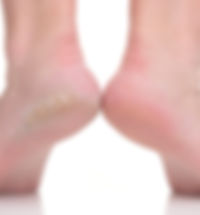 footlogix1.jpg