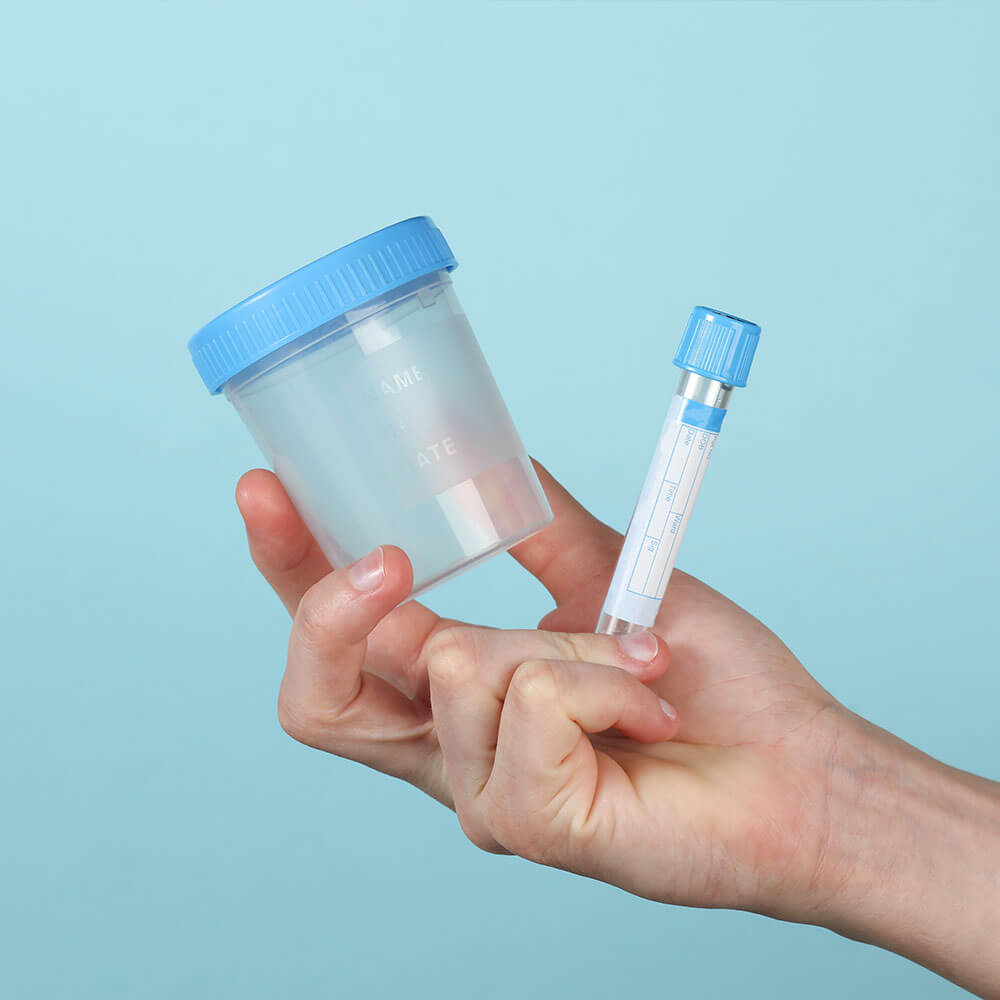 Nurse holding medical containers used for urine analysis and culture.