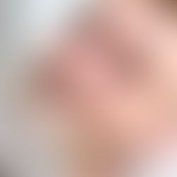 smiling men getting gaged for which type of veneer to be selected