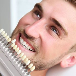 smiling men getting gaged for which type of veneer to be selected