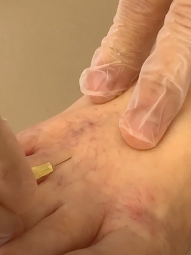 Ozonioterapia com Maria Teresa Fioravanti, na Casa Una, Salto SP