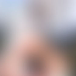 Pudendal Nerve Damage