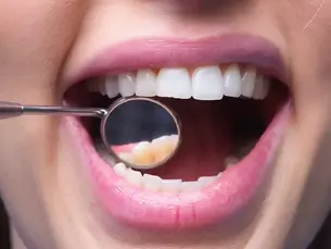 Diş Minesi Nasıl Güçlenir?