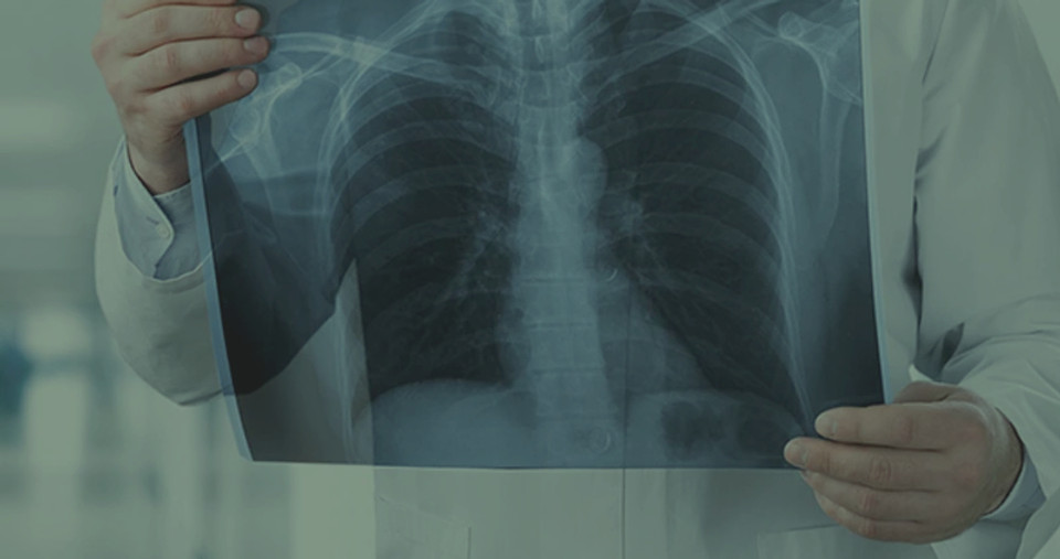 xray_edited.jpg