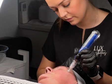 Skin needling at Lux Aesthetics Lilydale