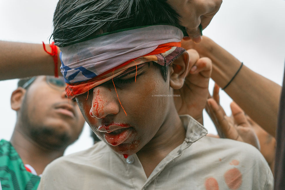 Injured protestor after police commotion