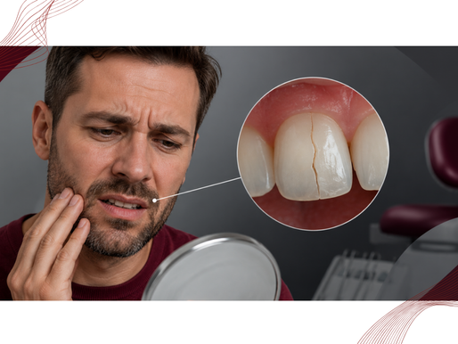 Dente trincado é perigoso? Descubra os riscos e a importância do diagnóstico precoce