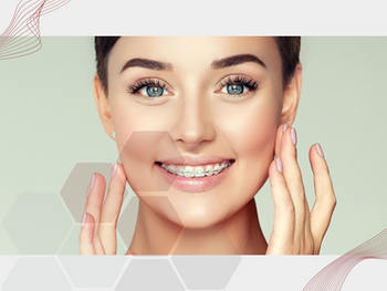 Vai usar Aparelho Ortodôntico? Quais exames são necessários