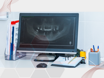 Saiba como a radiografia panorâmica funciona e os benefícios desse exame para saúde bucal