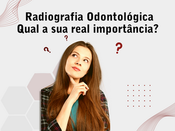 Radiografia Odontológica: Qual a sua real importância?