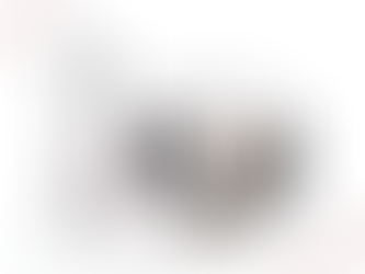 Extração Dental - Porque optar pela tomografia de alta resolução