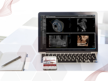 5 motivos para usar tomografia como diferencial competitivo na sua prática clínica