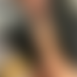 Valgus stress test (Albue)