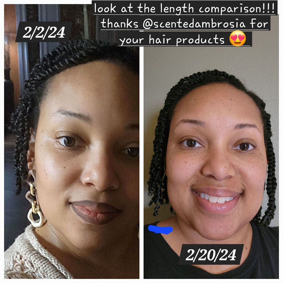 Thumbnail: Herbal infused Scalp Oil (2 oz)