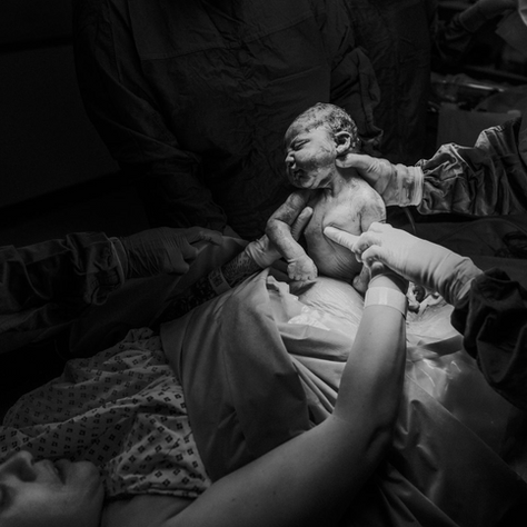 I delivered my own baby in theatre. The birth of george - Home Birth turned Maternal Caesarean using hypnobirthing.