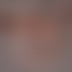 Myotherapy Facts #12