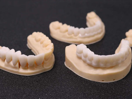 3D Printing in Dentistry: Benefits, Workflow & Real Case Uses
