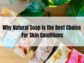 Why Natural Soap is the Best Choice for Skin Conditions