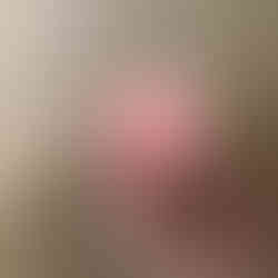 Bruno STP bovenaanzicht van de eikel/urethra