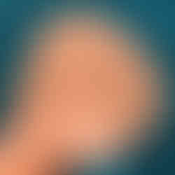 Monsieur Wiggle, close up of self-adhesive tab