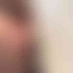 Packing with SP4 packer using MyPack strap, side view